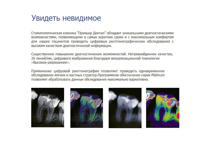 Удаление зубов лечение пульпита москве